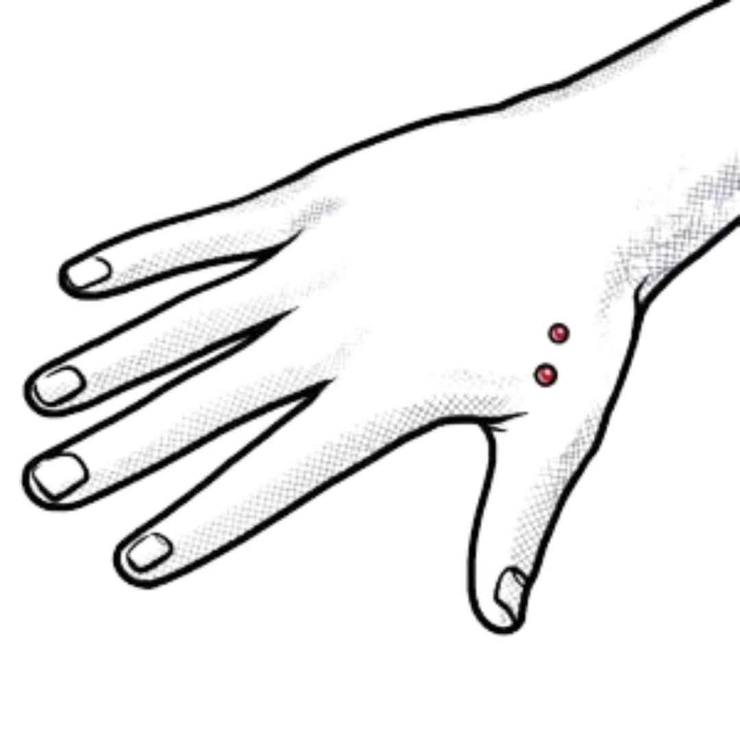 Dermal Anchor an der Hand
