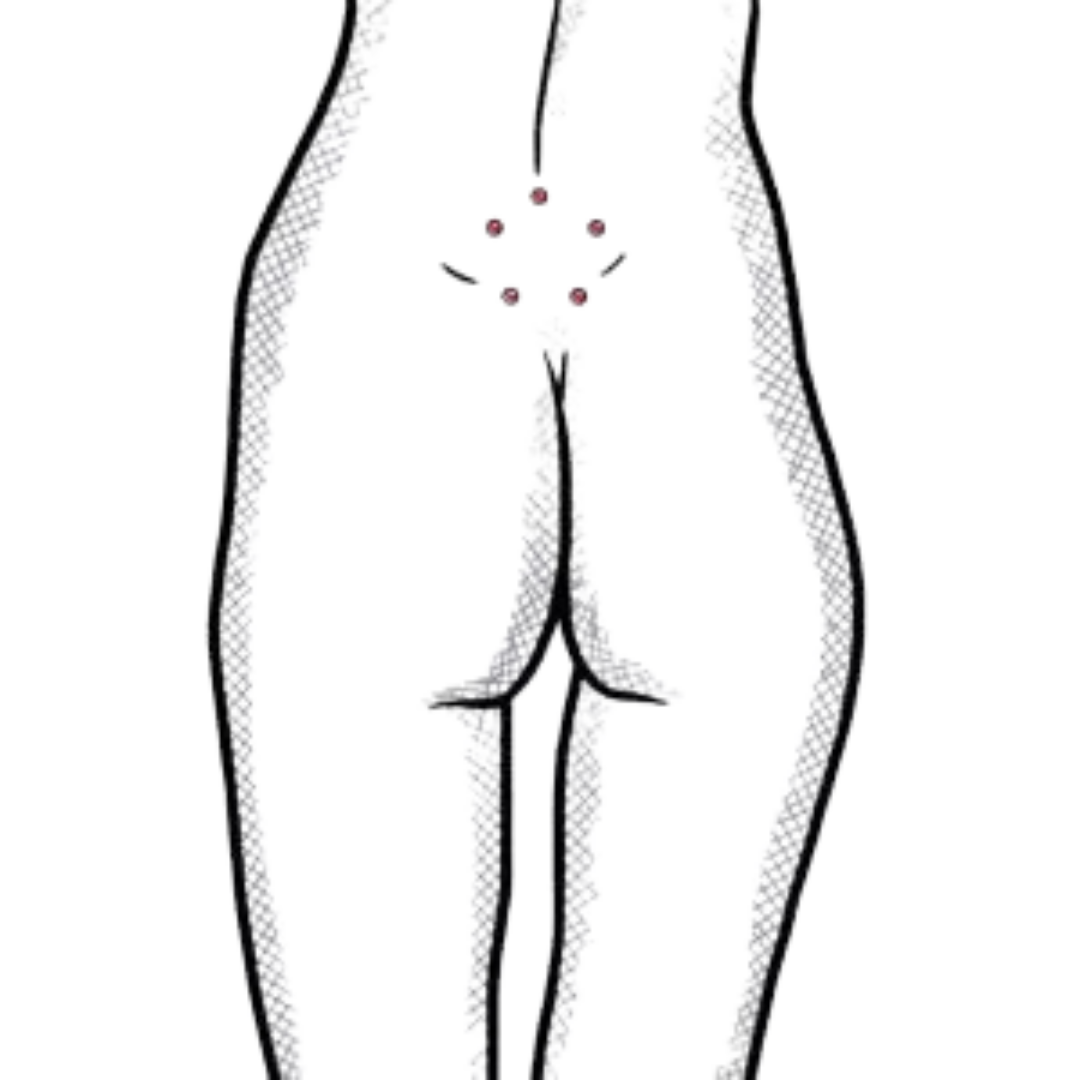 Dermal Anchor am Rücken