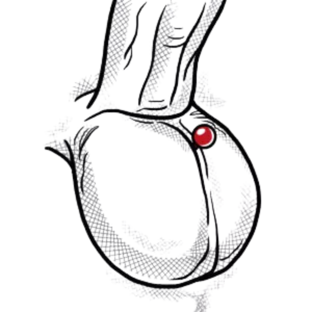 Transscrotal Piercing